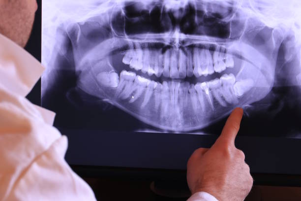 Best Emergency Denture Repair in Suncoast Estates, FL
