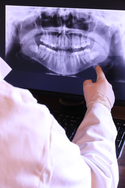 Best Emergency Denture Repair in Suncoast Estates, FL