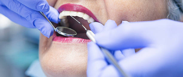 Best Emergency Treatment for Dental Infections or Abscesses in Suncoast Estates, FL
